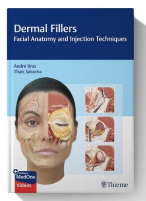 Dermal Fillers: Facial Anatomy and Injection Techniques