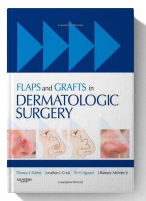 Flaps and Grafts in Dermatologic Surgery