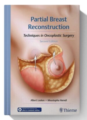 Partial Breast Reconstruction: Techniques in Oncoplastic Surgery 2nd Edition
