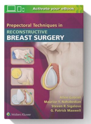 Prepectoral Techniques in Reconstructive Breast Surgery