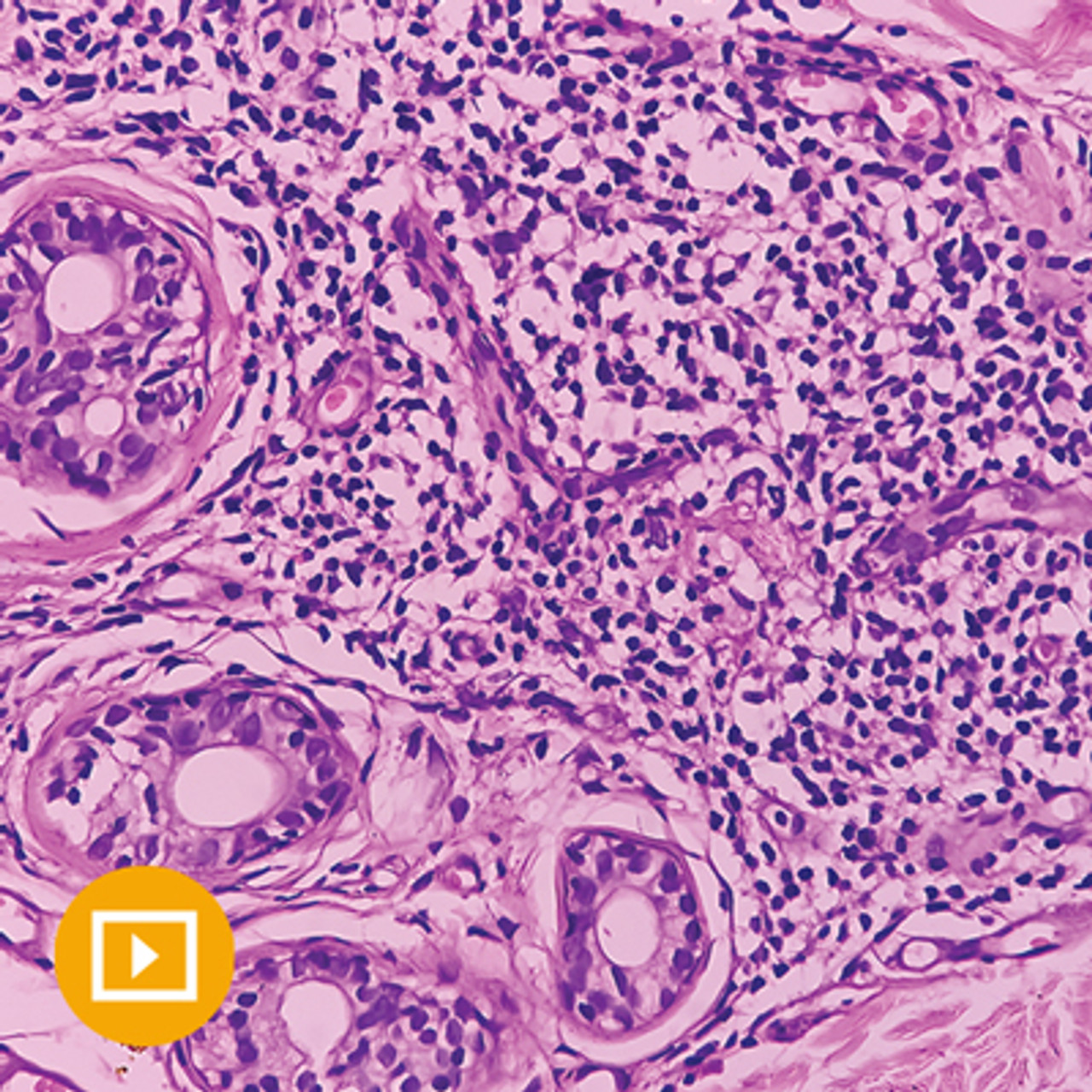 Oakstone Dermatopathology