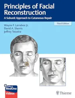 Principles of Facial Reconstruction: A Subunit Approach to Cutaneous Repair