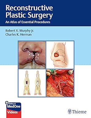 Reconstructive Plastic Surgery: An Atlas of Essential Procedures 1st Edition, Kindle Edition