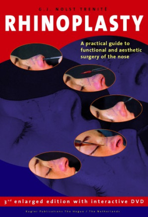 Rhinoplasty: A practical guide to functional and aesthetic surgery of the nose