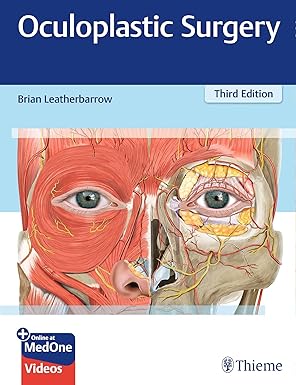 Oculoplastic Surgery 3rd Edition