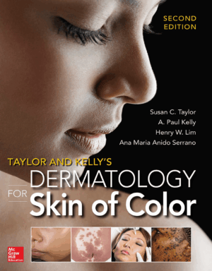 Taylor and Kelly’s Dermatology for Skin of Color 2/E